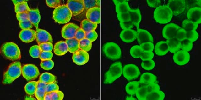 Anti-Cytokeratin 8/18 Antibody, clone L2A1 clone L2A1, from mouse