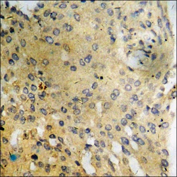 Anti-phospho-PI3-kinase p85-&#945;/&#947; (pTyr467/199) antibody produced in rabbit affinity isolated antibody