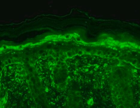 Monoclonal Anti-TRPV3 antibody produced in mouse clone S59-20, 1&#160;mg/mL, purified immunoglobulin