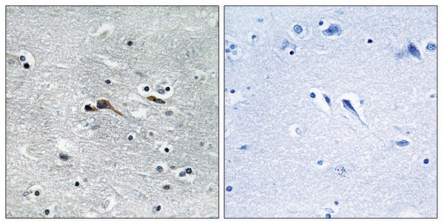 Anti-CYTL1 antibody produced in rabbit affinity isolated antibody