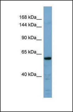 Anti-CDH23 antibody produced in rabbit affinity isolated antibody