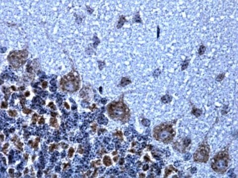 Anti-NMDAR1 Antibody, clone 1.17.2.6, rabbit monoclonal clone 1.17.2.6, from rabbit, unconjugated