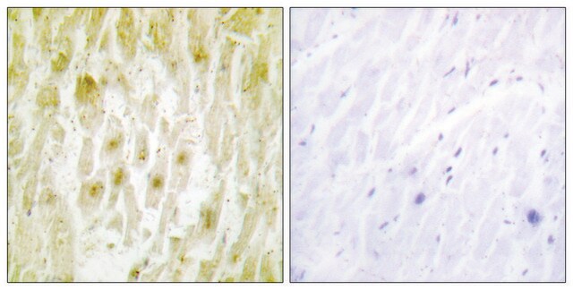 Anti-TF2E2 antibody produced in rabbit affinity isolated antibody