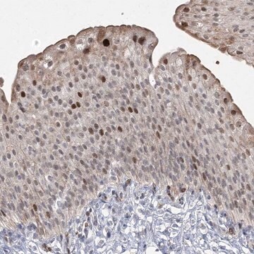 Anti-NSMCE4A antibody produced in rabbit Prestige Antibodies&#174; Powered by Atlas Antibodies, affinity isolated antibody, buffered aqueous glycerol solution