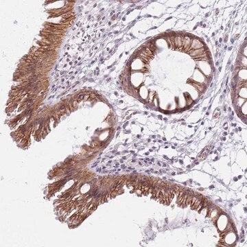 Anti-KCNA5 antibody produced in rabbit Prestige Antibodies&#174; Powered by Atlas Antibodies, affinity isolated antibody, buffered aqueous glycerol solution