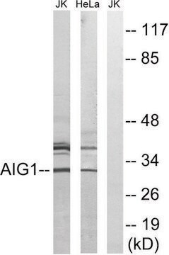 Anti-AIG1 antibody produced in rabbit affinity isolated antibody