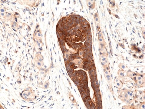 Anti-VEGF (VEGFA) Rabbit Monoclonal Antibody clone RM391, affinity purified immunoglobulin