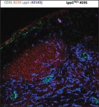 Anti-PPAP2A (AB1) antibody produced in rabbit IgG fraction of antiserum