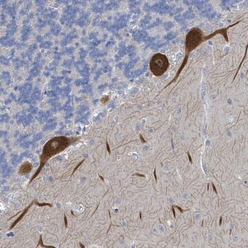 Anti-DGKZ antibody produced in rabbit Prestige Antibodies&#174; Powered by Atlas Antibodies, affinity isolated antibody, buffered aqueous glycerol solution