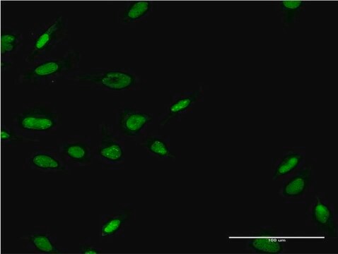 ANTI-LHX6 antibody produced in mouse clone 1B11, purified immunoglobulin, buffered aqueous solution