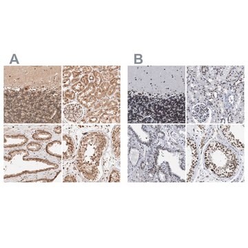 Anti-TPR antibody produced in rabbit Prestige Antibodies&#174; Powered by Atlas Antibodies, affinity isolated antibody, buffered aqueous glycerol solution, Ab3