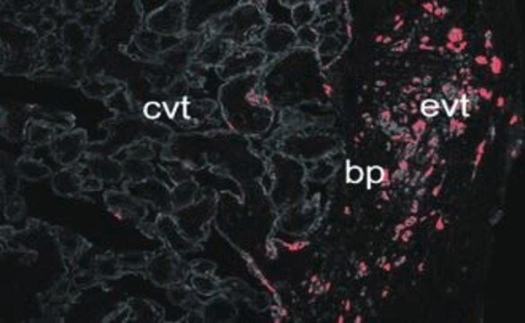 Monoclonal Anti-Cytokeratin Peptide 18&#8722;FITC antibody produced in mouse clone CY-90, purified immunoglobulin, buffered aqueous solution