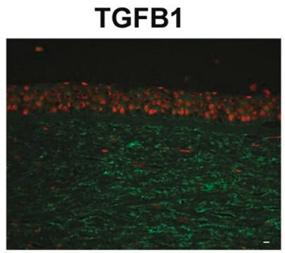 Anti-TGFBI antibody produced in rabbit IgG fraction of antiserum