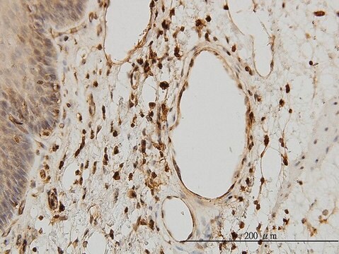 Monoclonal Anti-B2M antibody produced in mouse clone 3F9-2C2, purified immunoglobulin, buffered aqueous solution