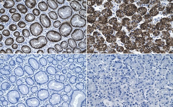 Anti-CA9 Antibody, clone 1B6 ZooMAb&#174; Rabbit Monoclonal recombinant, expressed in HEK 293 cells