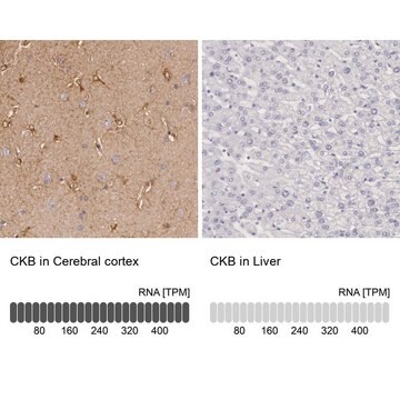 Anti-CKB antibody produced in rabbit Prestige Antibodies&#174; Powered by Atlas Antibodies, affinity isolated antibody, buffered aqueous glycerol solution