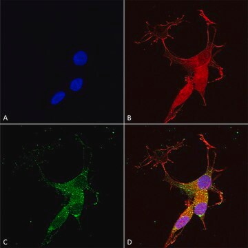 Monoclonal Anti-Copper Transporting Atpase 2 - Rpe antibody produced in mouse clone S62-29, purified immunoglobulin