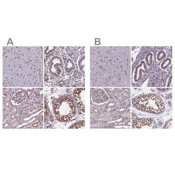 Anti-MPHOSPH8 antibody produced in rabbit Prestige Antibodies&#174; Powered by Atlas Antibodies, affinity isolated antibody, buffered aqueous glycerol solution