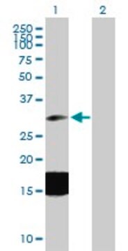 Anti-ESM1 antibody produced in mouse purified immunoglobulin, buffered aqueous solution