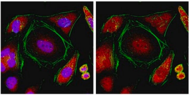 Anti-TNRC6B Antibody from rabbit, purified by affinity chromatography