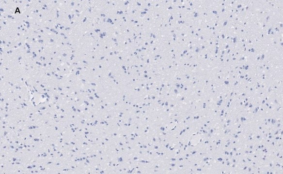 Anti-VGluT1 Antibody, clone 4O15, ZooMAb&#174; Rabbit Monoclonal recombinant, expressed in HEK 293 cells