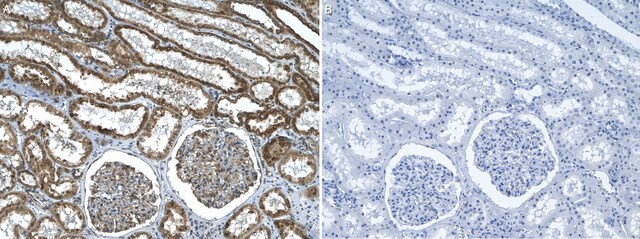 Anti-Claudin-5 Antibody, clone 3H12 ZooMAb&#174; Rabbit Monoclonal recombinant, expressed in HEK 293 cells