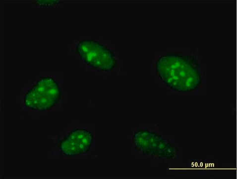 Anti-ZNF593 antibody produced in mouse purified immunoglobulin, buffered aqueous solution