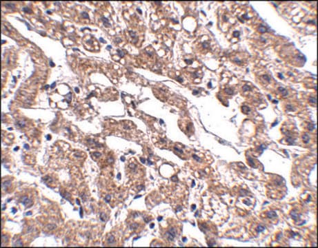 Anti-MACC1 antibody produced in rabbit affinity isolated antibody, buffered aqueous solution