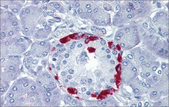 Anti-TEAD4 antibody produced in rabbit affinity isolated antibody