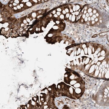 Anti-BCORL1 antibody produced in rabbit Prestige Antibodies&#174; Powered by Atlas Antibodies, affinity isolated antibody, buffered aqueous glycerol solution