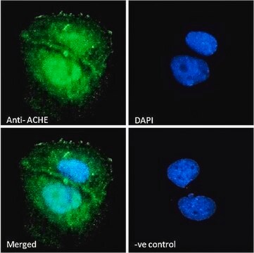 抗ACHE抗体 ヤギ宿主抗体 affinity isolated antibody, buffered aqueous solution