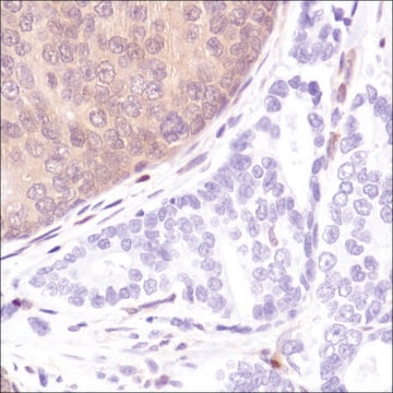 Anti-PTEN antibody, Rabbit monoclonal clone SP218, recombinant, expressed in proprietary host, affinity isolated antibody