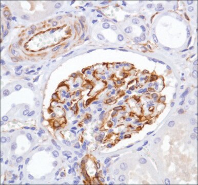 Anti-Nestin antibody, Rabbit monoclonal clone SP103, recombinant, expressed in proprietary host, affinity isolated antibody