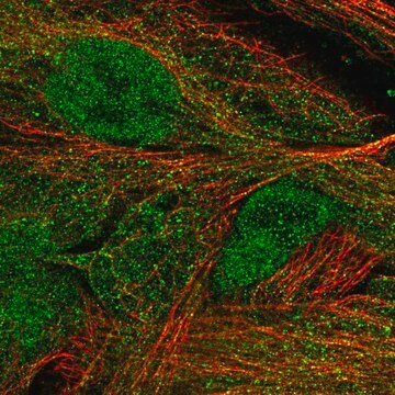 Anti-MASP1 antibody produced in rabbit Ab1, Prestige Antibodies&#174; Powered by Atlas Antibodies, affinity isolated antibody, buffered aqueous glycerol solution