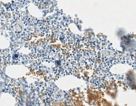 Anti-Procollagen Type I Antibody, CT, clone PCIDG10 (Ascites Free) clone PCIDG10, from mouse