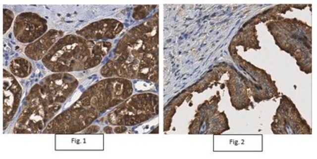 Anti-LDHB Antibody from rabbit, purified by affinity chromatography