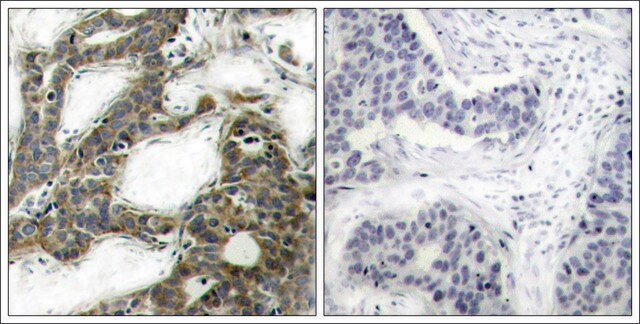 Anti-CTNNB1 (Ab-33) antibody produced in rabbit affinity isolated antibody