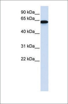 Anti-CHAT affinity isolated antibody