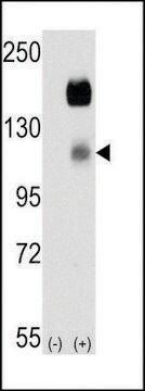 ANTI-CCK4 (PTK7)(N-TERMINAL) antibody produced in rabbit IgG fraction of antiserum, buffered aqueous solution