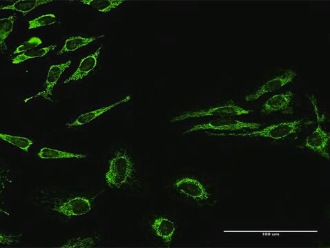 Anti-HSPD1 antibody produced in rabbit purified immunoglobulin, buffered aqueous solution