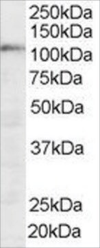 Anti-SART1 antibody produced in goat affinity isolated antibody, buffered aqueous solution