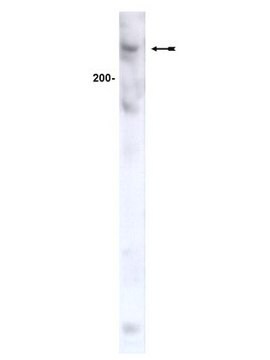 Anti-ATM Antibody, clone AM9 ascites fluid, clone AM9, Upstate&#174;