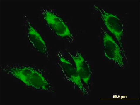 Anti-UQCRC1 antibody produced in mouse purified immunoglobulin, buffered aqueous solution