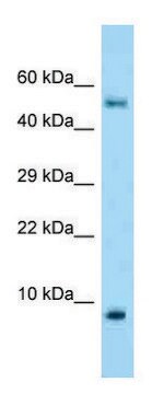 Anti-S100A10 antibody produced in rabbit affinity isolated antibody