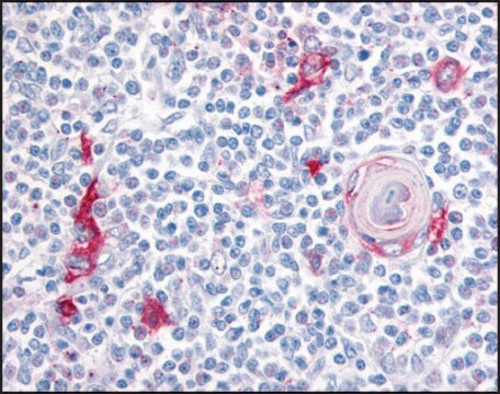 Anti-ITGA4 (AB2) antibody produced in rabbit affinity isolated antibody, buffered aqueous solution