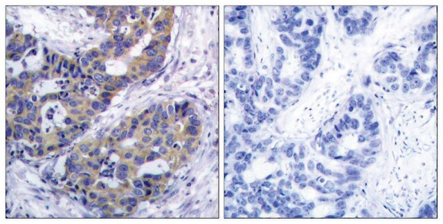 Anti-IRS-1 antibody produced in rabbit affinity isolated antibody