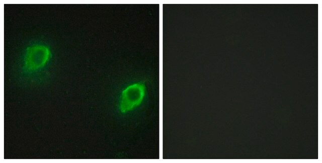 Anti-AKAP5 antibody produced in rabbit affinity isolated antibody