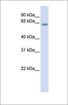 Anti-TCF7L2 (ab2) antibody produced in rabbit affinity isolated antibody