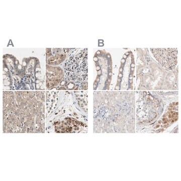 Anti-PROS1 antibody produced in rabbit Prestige Antibodies&#174; Powered by Atlas Antibodies, affinity isolated antibody, buffered aqueous glycerol solution