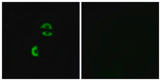 Anti-LDLRAD3 antibody produced in rabbit affinity isolated antibody